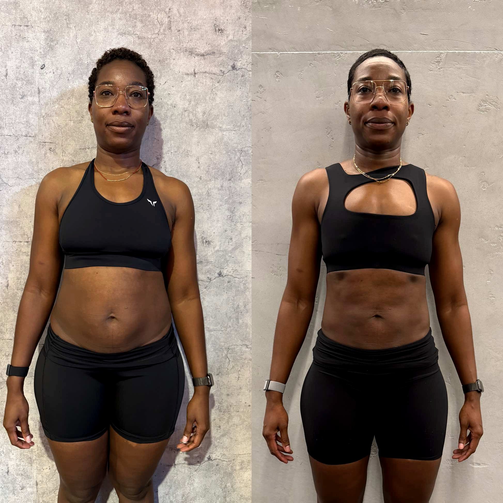 Female client before and after a NOVABODY transformation